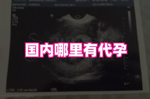 长春助孕网 4